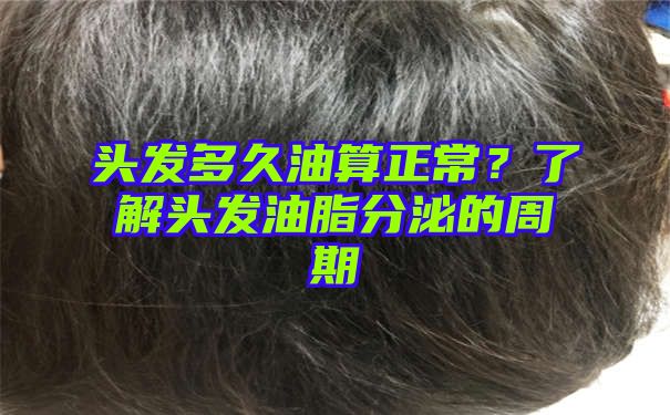 头发多久油算正常？了解头发油脂分泌的周期